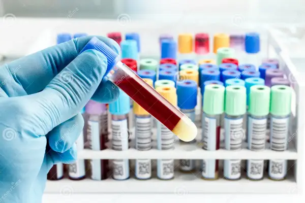 Bloedbuisje voor PSA-test
